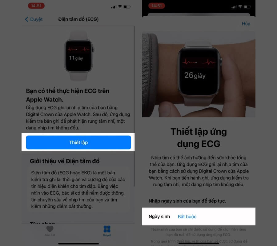 Hướng dẫn đo ECG (Điện tâm đồ) trên Apple Watch, giúp theo dõi sức khỏe trái tim - Hình 2