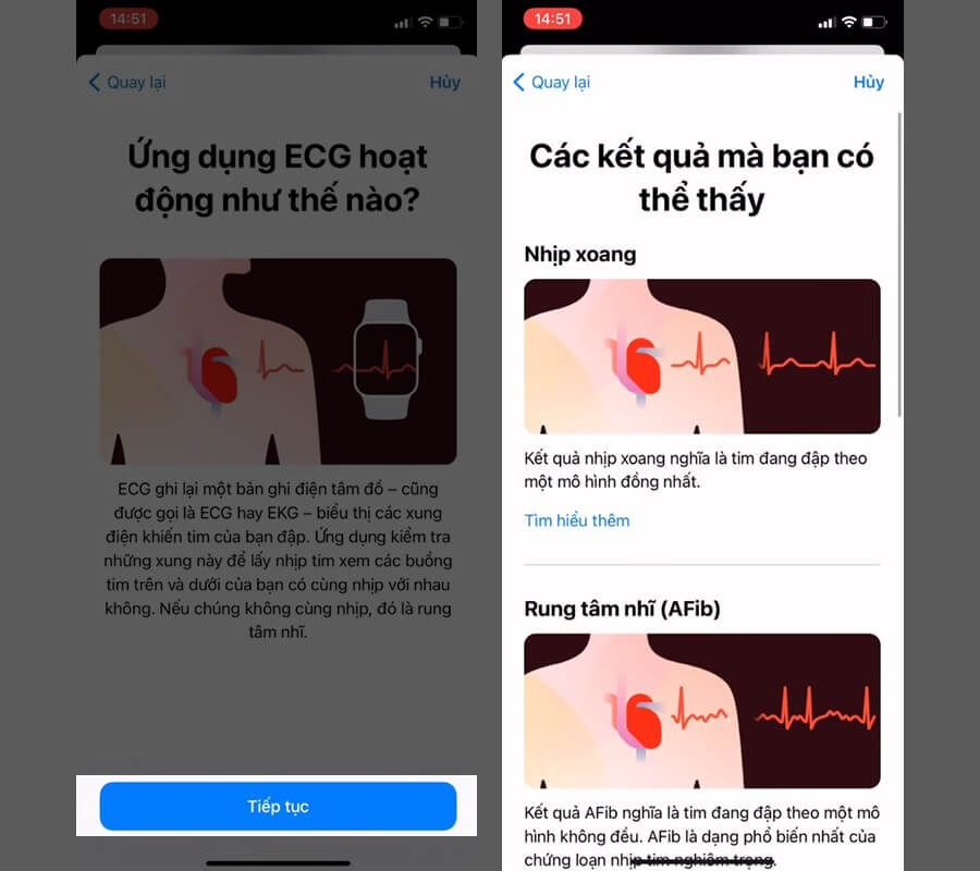 Hướng dẫn đo ECG (Điện tâm đồ) trên Apple Watch, giúp theo dõi sức khỏe trái tim - Hình 3