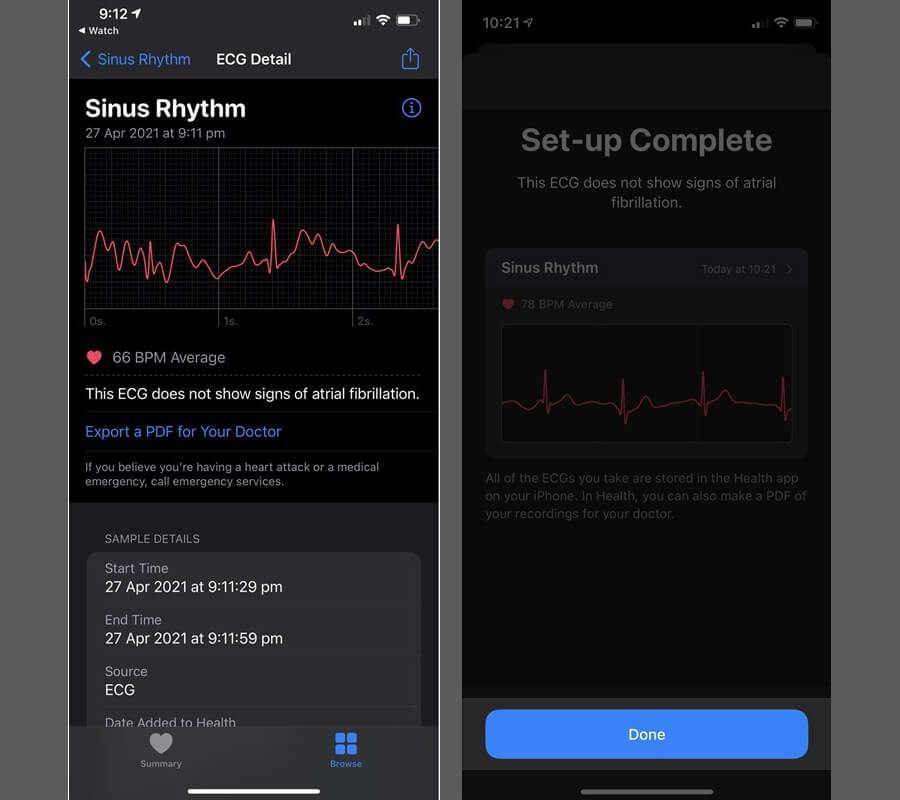 Hướng dẫn đo ECG (Điện tâm đồ) trên Apple Watch, giúp theo dõi sức khỏe trái tim - Hình 6