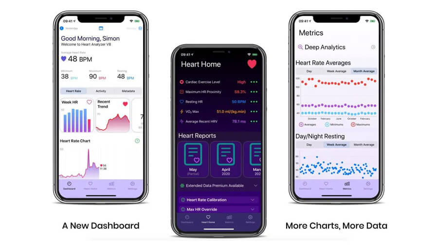 Ứng dụng Heart Analyzer trên iPhone và Apple Watch nhận nhiều cập nhật mới Ứng dụng Heart Analyzer trên iPhone và Apple Watch nhận nhiều cập nhật mới